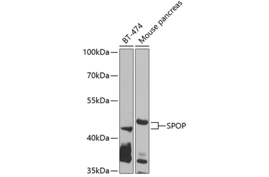 Western Blot - Anti-SPOP Antibody (A12151) - Antibodies.com
