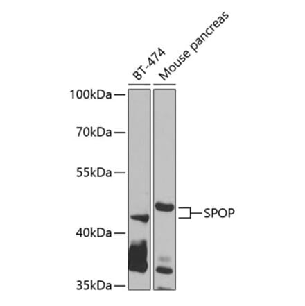 Western Blot - Anti-SPOP Antibody (A12151) - Antibodies.com