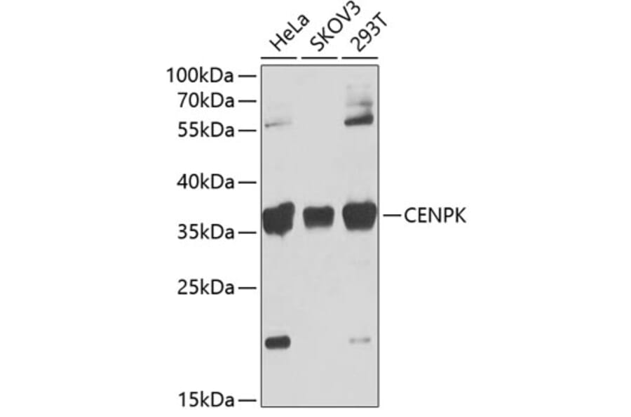 Western Blot - Anti-FKSG14/p33 Antibody (A12152) - Antibodies.com