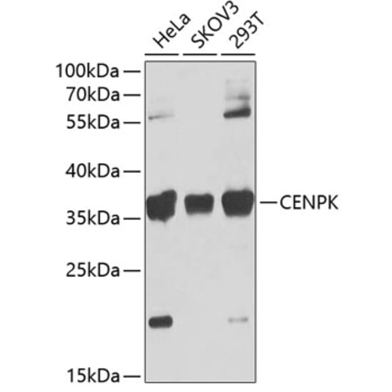 Western Blot - Anti-FKSG14/p33 Antibody (A12152) - Antibodies.com