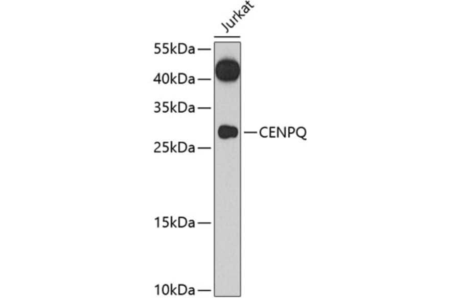 Western Blot - Anti-CENPQ Antibody (A7628) - Antibodies.com