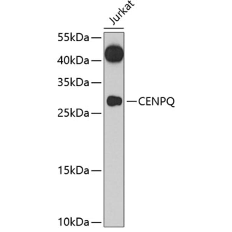 Western Blot - Anti-CENPQ Antibody (A7628) - Antibodies.com