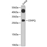 Western Blot - Anti-CENPQ Antibody (A7628) - Antibodies.com