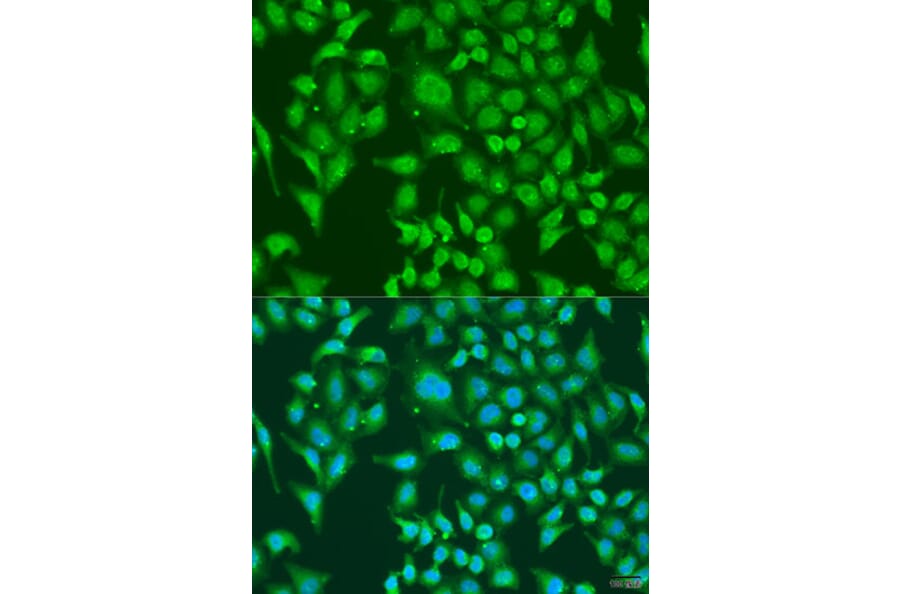 Immunofluorescence - Anti-CENPQ Antibody (A7628) - Antibodies.com