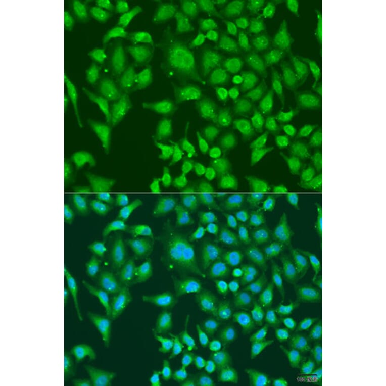 Immunofluorescence - Anti-CENPQ Antibody (A7628) - Antibodies.com