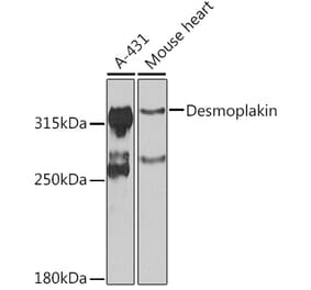 Western Blot - Anti-Desmoplakin Antibody (A12154) - Antibodies.com