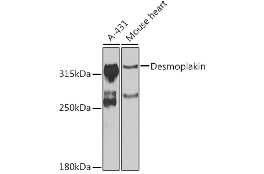Western Blot - Anti-Desmoplakin Antibody (A12154) - Antibodies.com