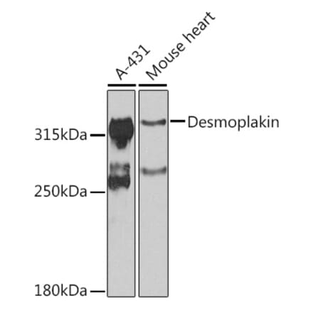 Western Blot - Anti-Desmoplakin Antibody (A12154) - Antibodies.com