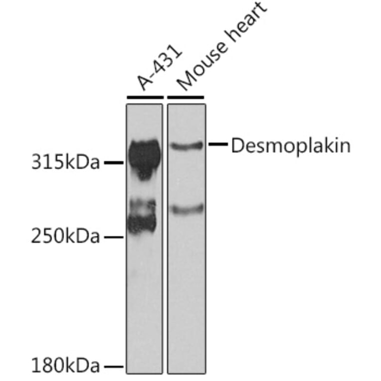 Western Blot - Anti-Desmoplakin Antibody (A12154) - Antibodies.com