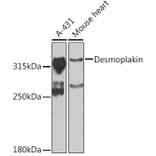 Western Blot - Anti-Desmoplakin Antibody (A12154) - Antibodies.com
