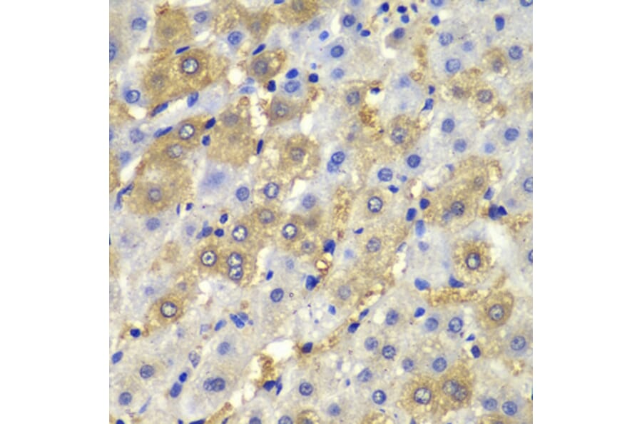 Immunohistochemistry - Anti-Desmoplakin Antibody (A12154) - Antibodies.com