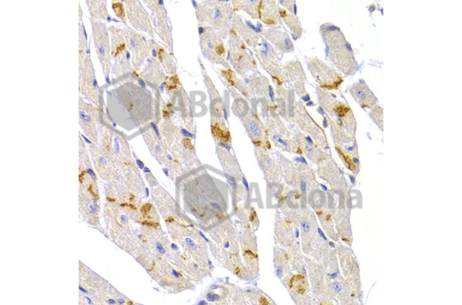 Immunohistochemistry - Anti-Desmoplakin Antibody (A12154) - Antibodies.com