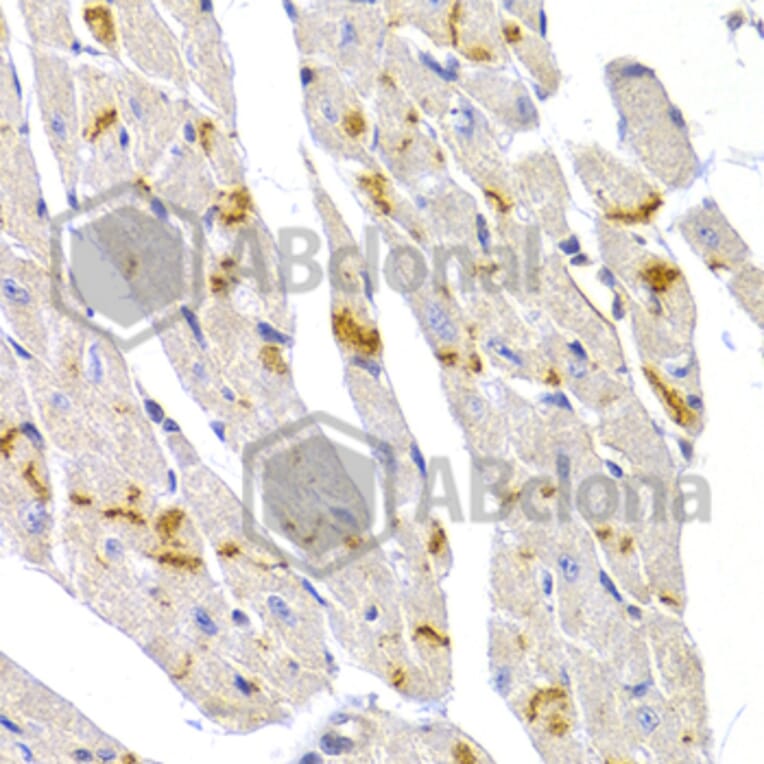 Immunohistochemistry - Anti-Desmoplakin Antibody (A12154) - Antibodies.com
