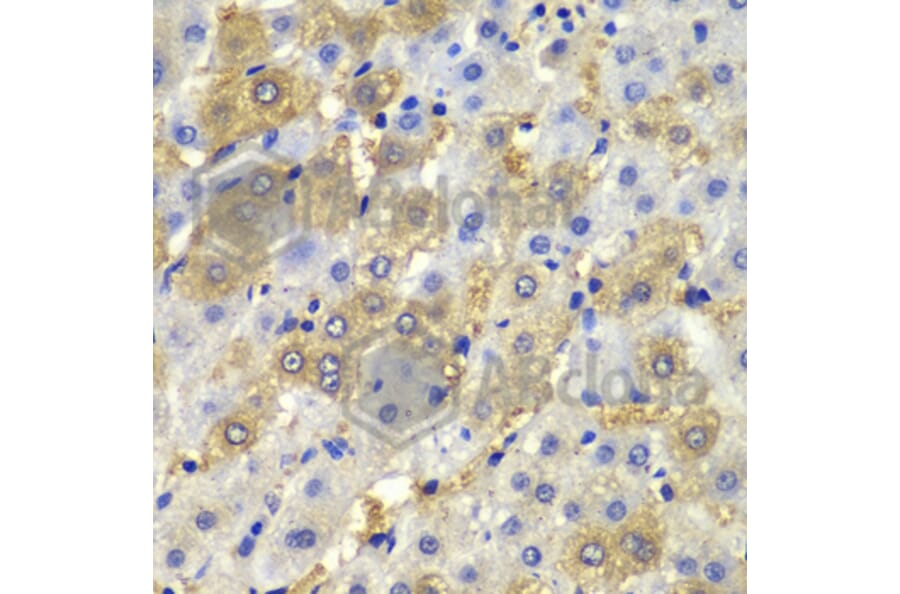 Immunohistochemistry - Anti-Desmoplakin Antibody (A12154) - Antibodies.com