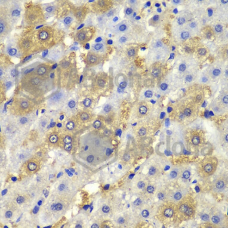 Immunohistochemistry - Anti-Desmoplakin Antibody (A12154) - Antibodies.com