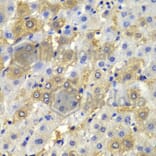 Immunohistochemistry - Anti-Desmoplakin Antibody (A12154) - Antibodies.com