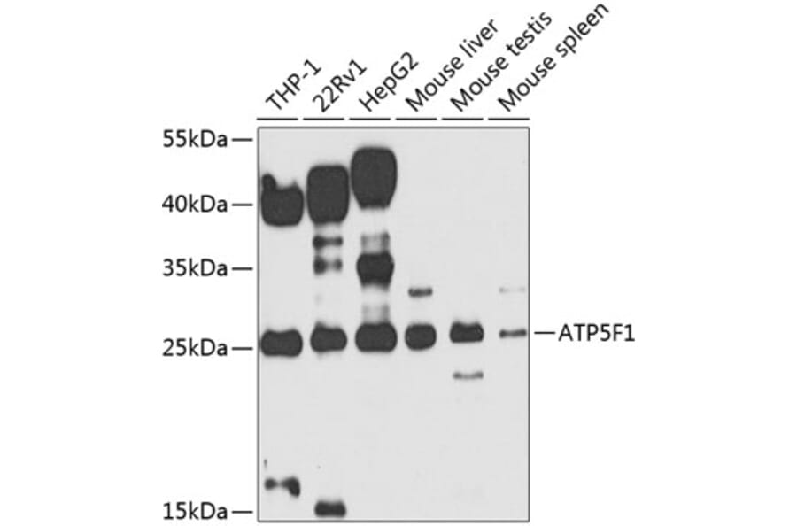 Western Blot - Anti-ATP5F1 Antibody (A12155) - Antibodies.com