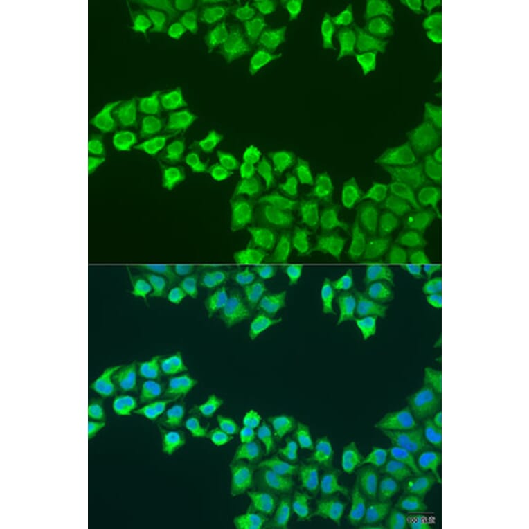 Immunofluorescence - Anti-ATP5F1 Antibody (A12155) - Antibodies.com