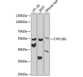 Western Blot - Anti-CYP11B1 Antibody (A12156) - Antibodies.com