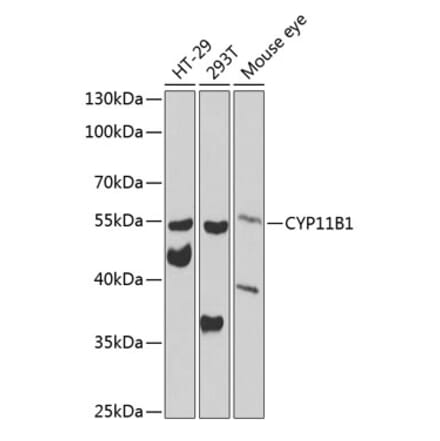 Western Blot - Anti-CYP11B1 Antibody (A12156) - Antibodies.com