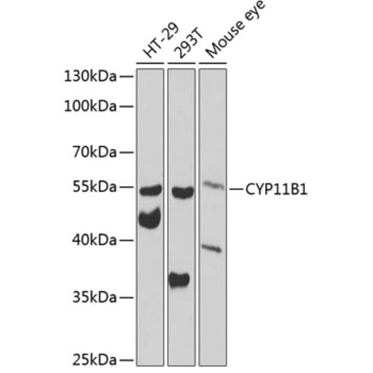 Western Blot - Anti-CYP11B1 Antibody (A12156) - Antibodies.com