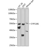 Western Blot - Anti-CYP11B1 Antibody (A12156) - Antibodies.com