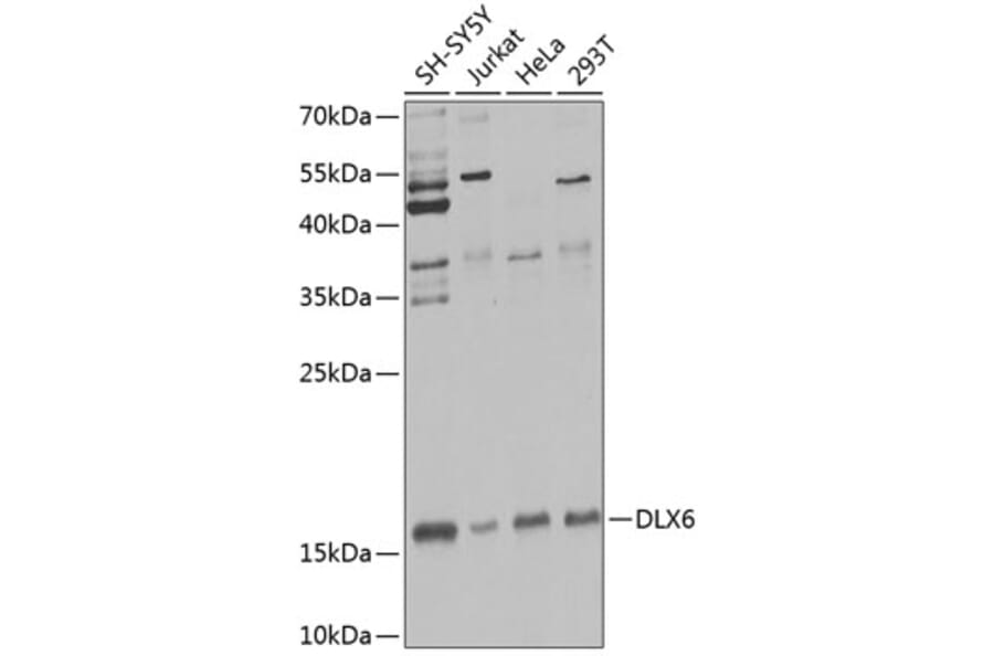 Western Blot - Anti-Dlx6 Antibody (A12157) - Antibodies.com