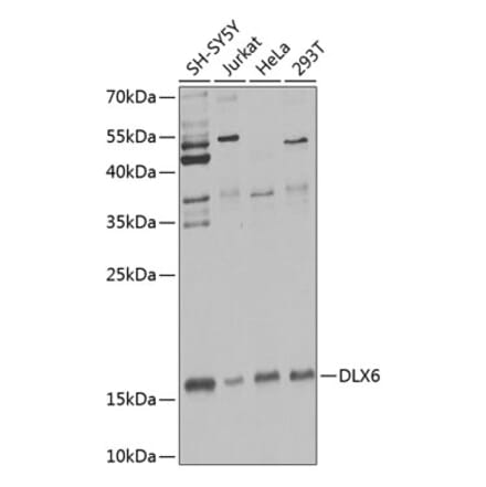 Western Blot - Anti-Dlx6 Antibody (A12157) - Antibodies.com