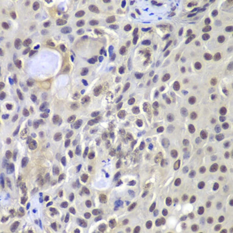 Immunohistochemistry - Anti-DNA PKcs Antibody (A12159) - Antibodies.com