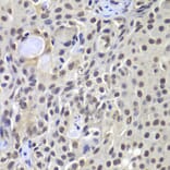 Immunohistochemistry - Anti-DNA PKcs Antibody (A12159) - Antibodies.com