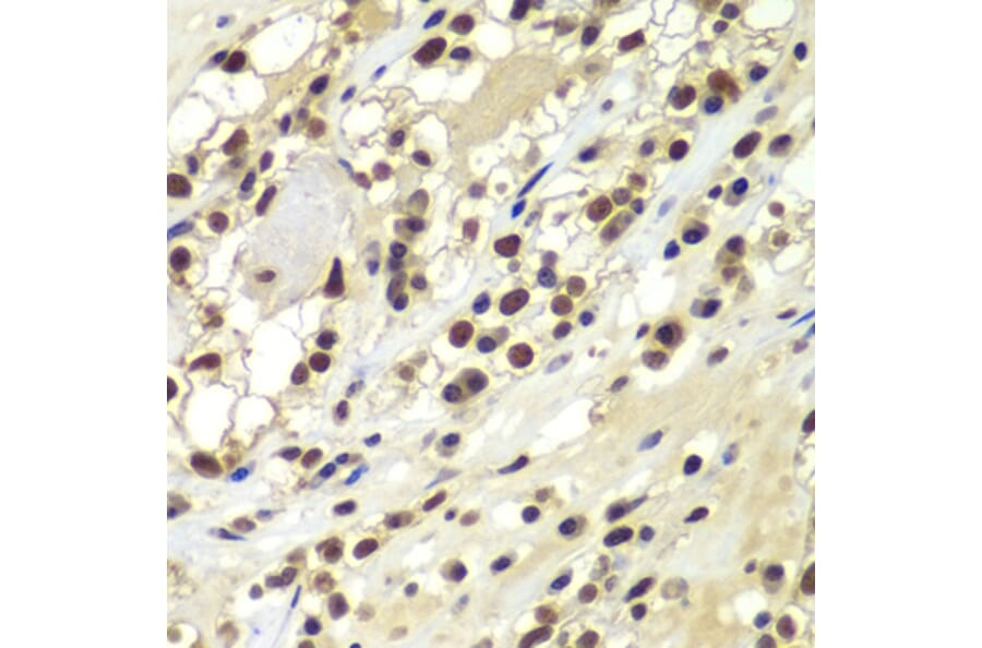 Immunohistochemistry - Anti-DNA PKcs Antibody (A12159) - Antibodies.com