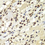 Immunohistochemistry - Anti-DNA PKcs Antibody (A12159) - Antibodies.com