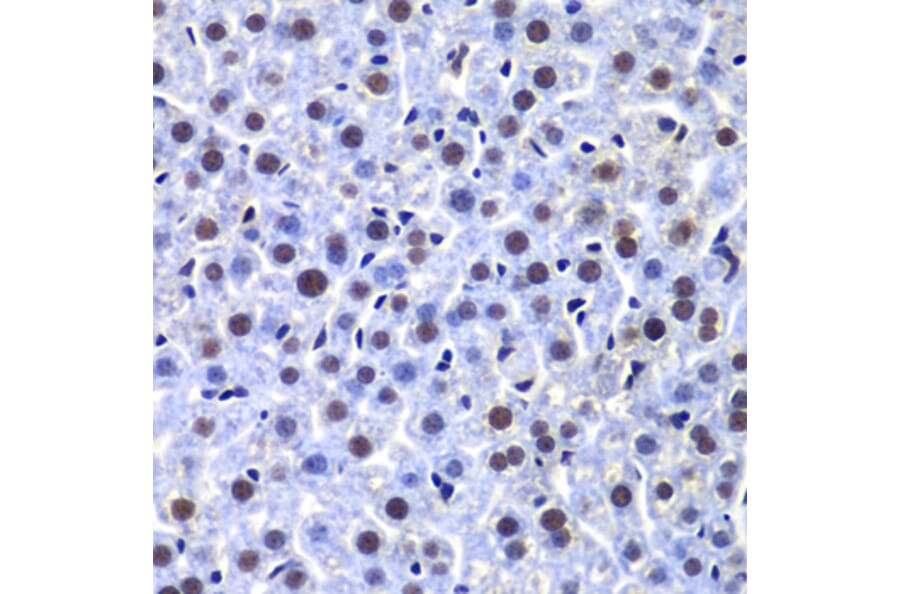 Immunohistochemistry - Anti-DNA PKcs Antibody (A12159) - Antibodies.com