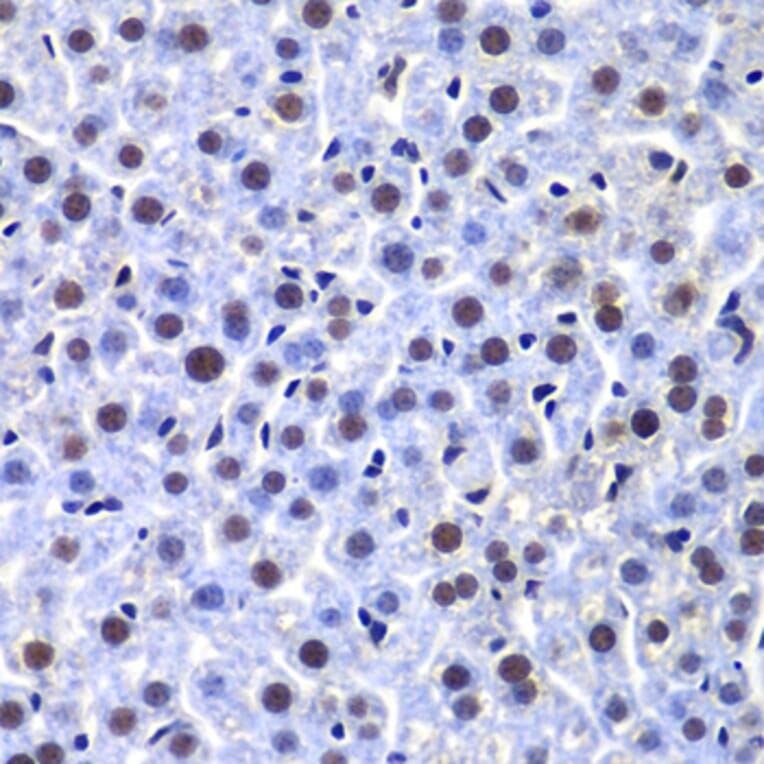 Immunohistochemistry - Anti-DNA PKcs Antibody (A12159) - Antibodies.com