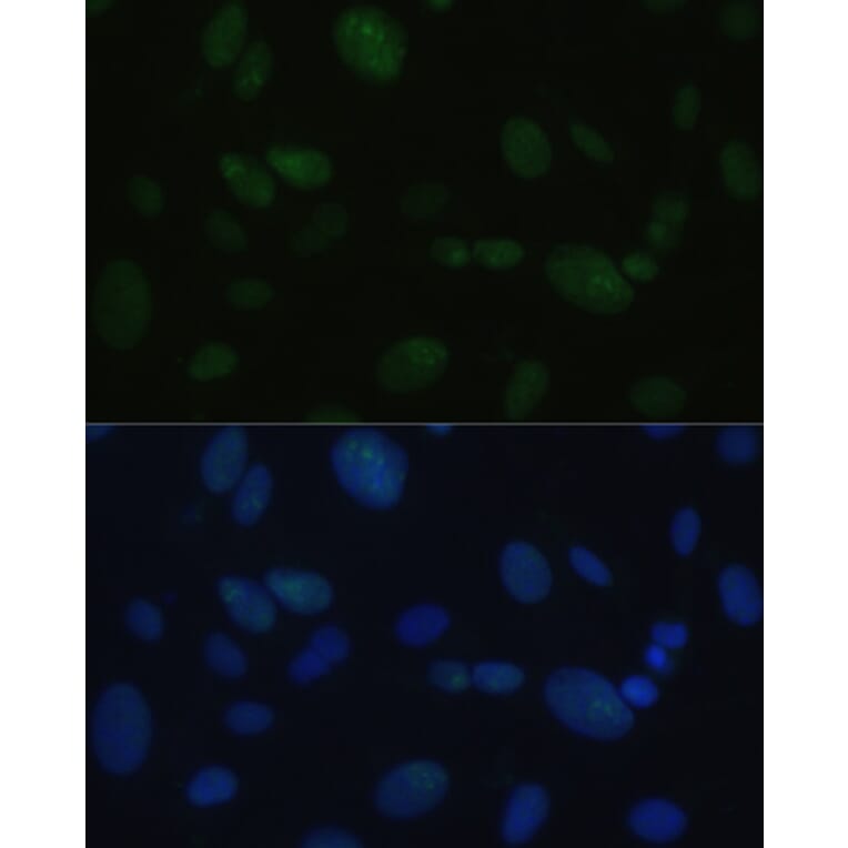 Immunofluorescence - Anti-DNA PKcs Antibody (A12159) - Antibodies.com