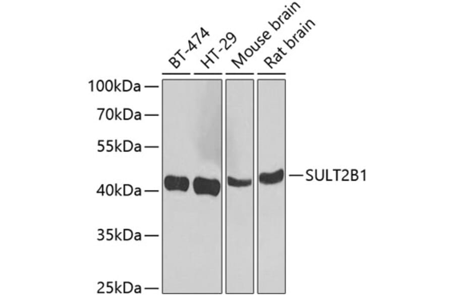 Western Blot - Anti-SULT2B1 Antibody (A12160) - Antibodies.com