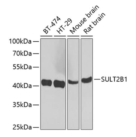 Western Blot - Anti-SULT2B1 Antibody (A12160) - Antibodies.com