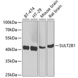 Western Blot - Anti-SULT2B1 Antibody (A12160) - Antibodies.com