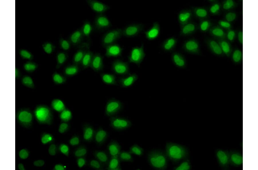 Immunofluorescence - Anti-SULT2B1 Antibody (A12160) - Antibodies.com