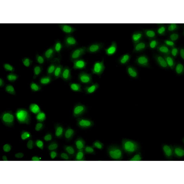 Immunofluorescence - Anti-SULT2B1 Antibody (A12160) - Antibodies.com