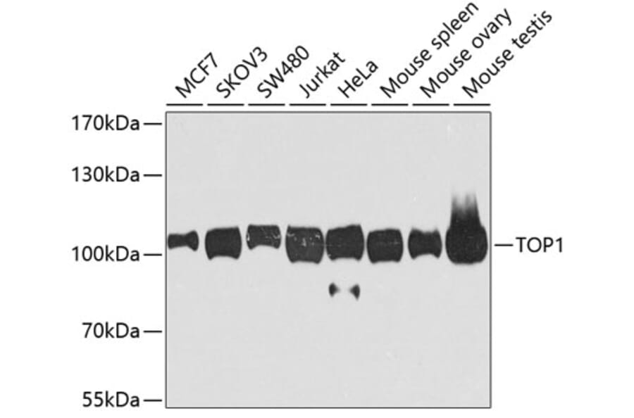 Western Blot - Anti-TOP1 Antibody (A7741) - Antibodies.com