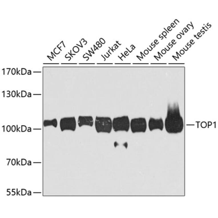 Western Blot - Anti-TOP1 Antibody (A7741) - Antibodies.com