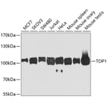 Western Blot - Anti-TOP1 Antibody (A7741) - Antibodies.com