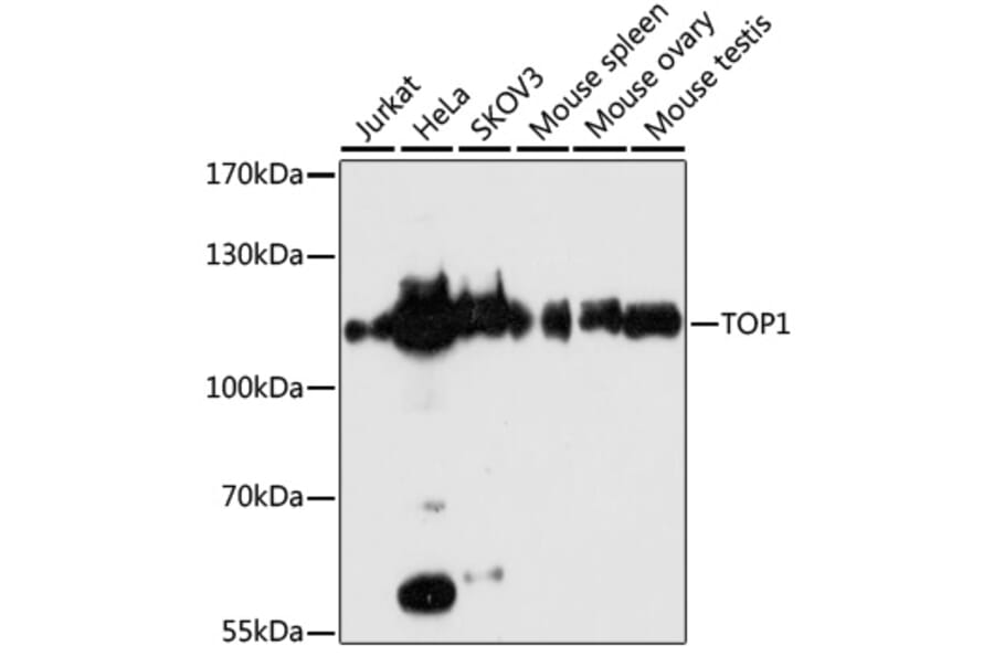 Western Blot - Anti-TOP1 Antibody (A7741) - Antibodies.com