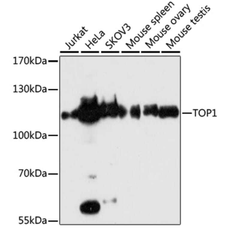 Western Blot - Anti-TOP1 Antibody (A7741) - Antibodies.com