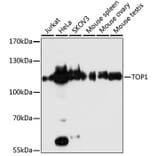 Western Blot - Anti-TOP1 Antibody (A7741) - Antibodies.com