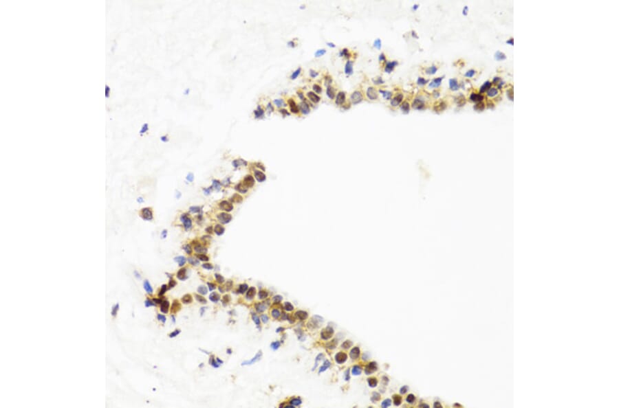 Immunohistochemistry - Anti-TOP1 Antibody (A7741) - Antibodies.com