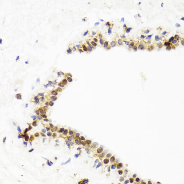 Immunohistochemistry - Anti-TOP1 Antibody (A7741) - Antibodies.com
