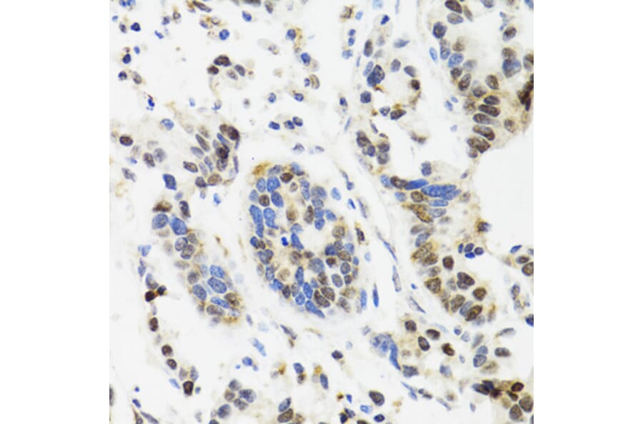 Immunohistochemistry - Anti-TOP1 Antibody (A7741) - Antibodies.com