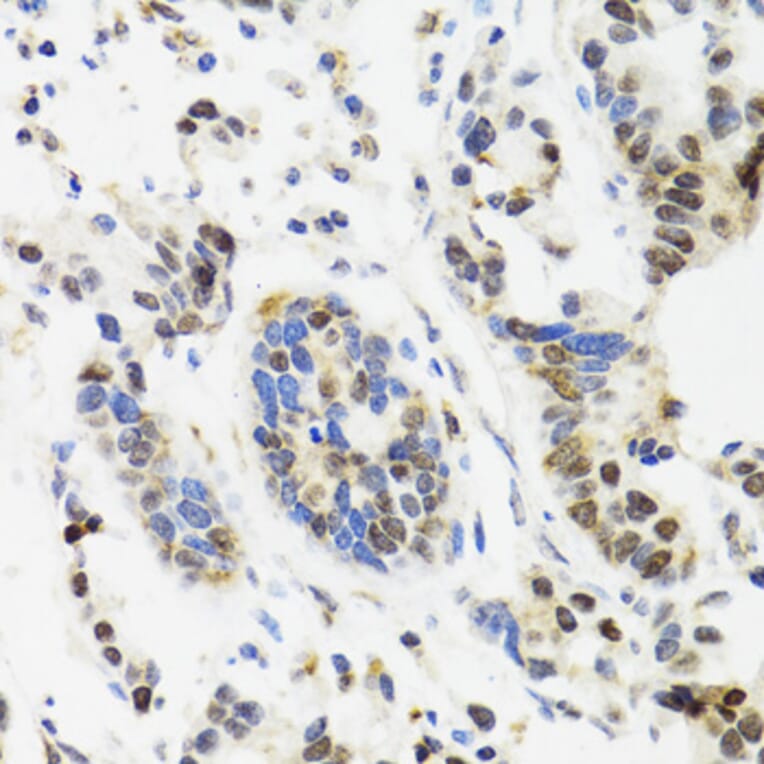 Immunohistochemistry - Anti-TOP1 Antibody (A7741) - Antibodies.com
